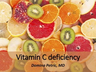 Vitamin C deficiency
Domina Petric, MD
 