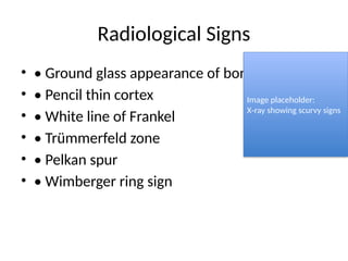 Spur Sign Radiological Comprehensive Overview of Vitamin C: Functions, Deficiency, and ...