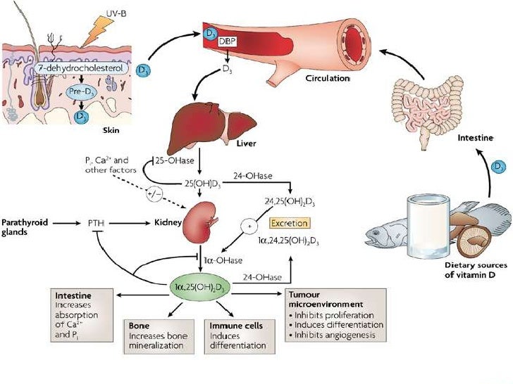 Osteoporosis Cases