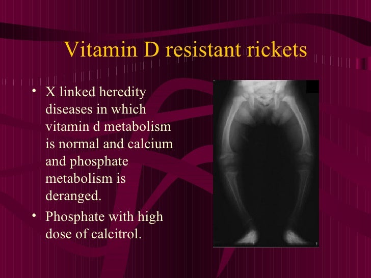vitamin-d