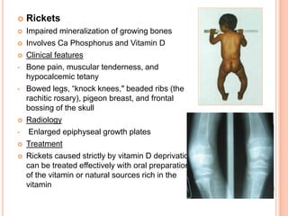    Rickets
   Impaired mineralization of growing bones
   Involves Ca Phosphorus and Vitamin D
   Clinical features
•   Bone pain, muscular tenderness, and
    hypocalcemic tetany
•   Bowed legs, “knock knees," beaded ribs (the
    rachitic rosary), pigeon breast, and frontal
    bossing of the skull
   Radiology
•    Enlarged epiphyseal growth plates
   Treatment
   Rickets caused strictly by vitamin D deprivation
    can be treated effectively with oral preparations
    of the vitamin or natural sources rich in the
    vitamin
 