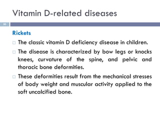 Vitamin D-related diseases
20
Rickets
 The classic vitamin D deficiency disease in children.
 The disease is characteriz...