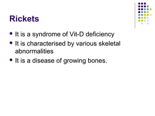 Rickets
 It is a syndrome of Vit-D deficiency
 It is characterised by various skeletal
abnormalities
 It is a disease of growing bones.
 