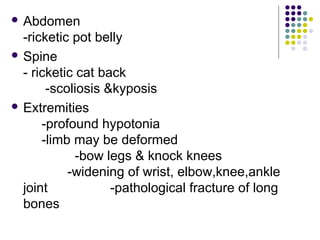  Abdomen
-ricketic pot belly
 Spine
- ricketic cat back
-scoliosis &kyposis
 Extremities
-profound hypotonia
-limb may be deformed
-bow legs & knock knees
-widening of wrist, elbow,knee,ankle
joint -pathological fracture of long
bones
 
