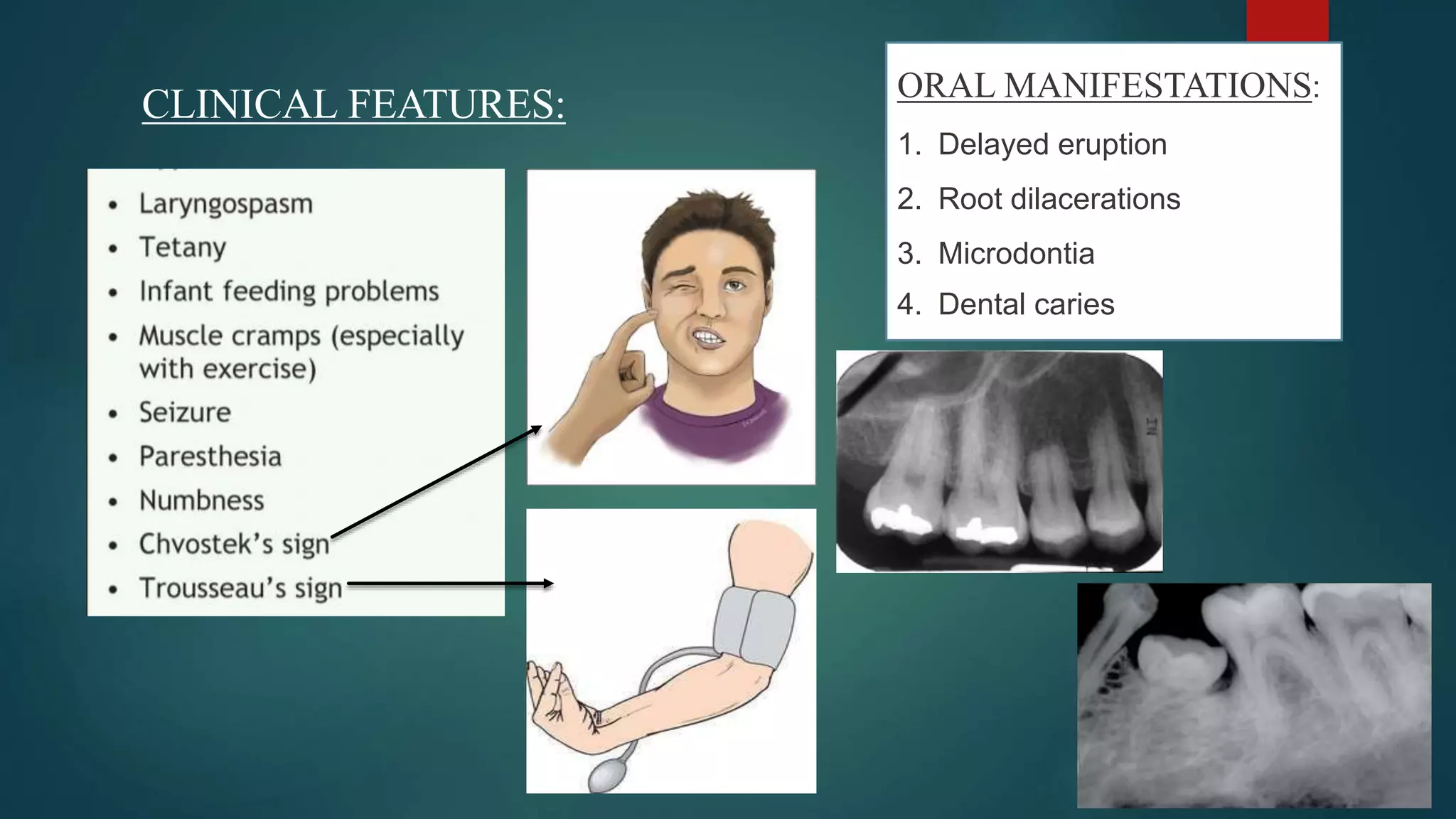 CLINICAL FEATURES: ORAL MANIFESTATIONS:
1. Delayed eruption
2. Root dilacerations
3. Microdontia
4. Dental caries
 