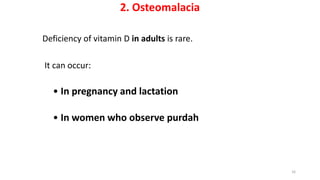 2. Osteomalacia
Deficiency of vitamin D in adults is rare.
It can occur:
• In pregnancy and lactation
• In women who observe purdah
16
 