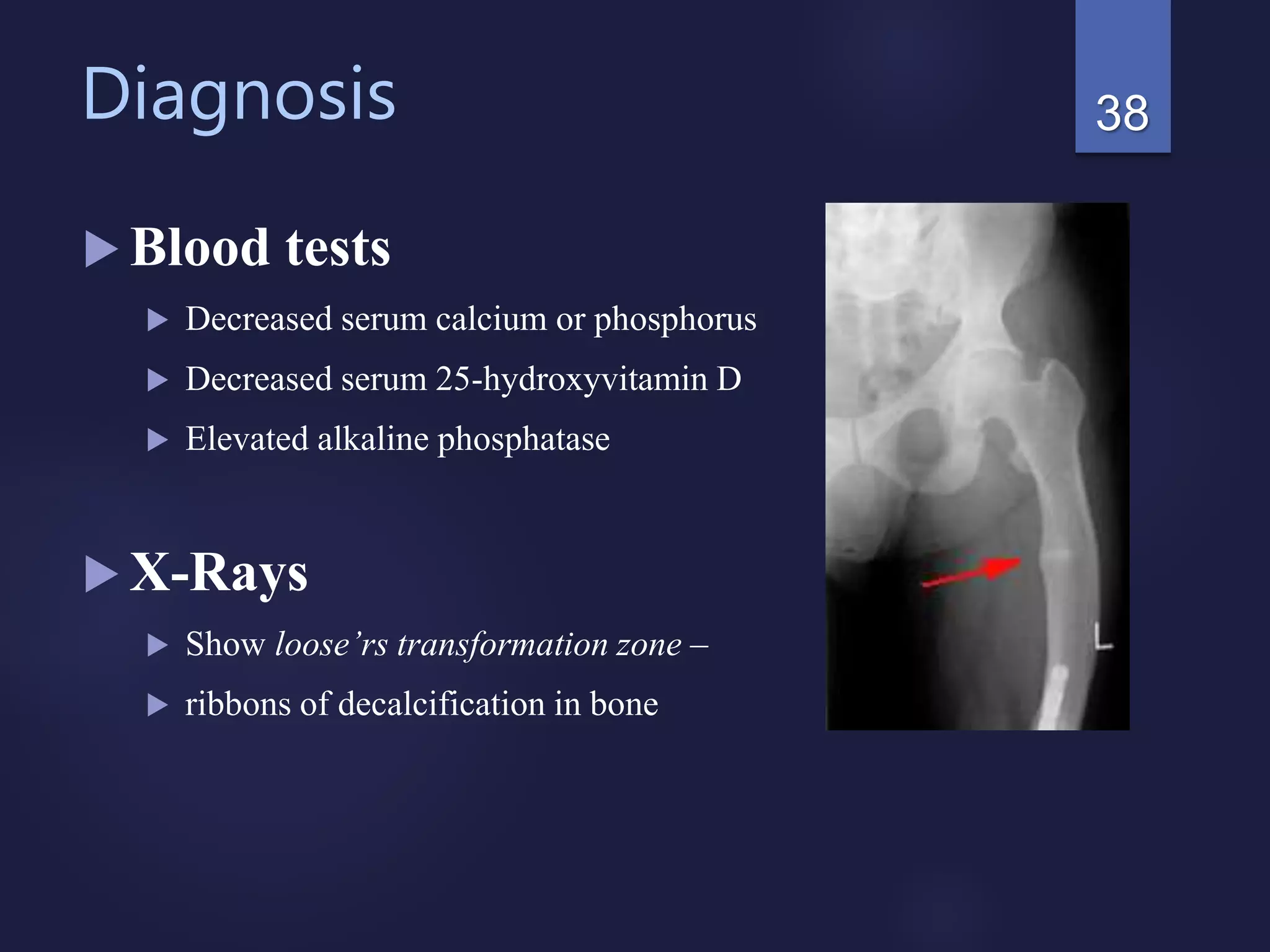 Diagnosis
 Blood tests
 Decreased serum calcium or phosphorus
 Decreased serum 25-hydroxyvitamin D
 Elevated alkaline phosphatase
 X-Rays
 Show loose’rs transformation zone –
 ribbons of decalcification in bone
38
 