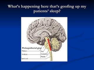 What’s happening here that’s goofing up my patients’ sleep? Periaquiductal gray 