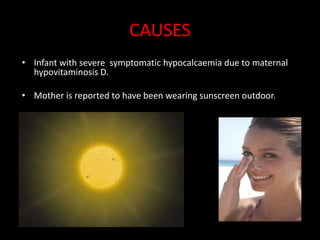 CAUSES
• Infant with severe symptomatic hypocalcaemia due to maternal
  hypovitaminosis D.

• Mother is reported to have been wearing sunscreen outdoor.
 