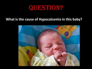 QUESTION?
What is the cause of Hypocalcemia in this baby?
 