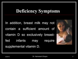 Deficiency Symptoms
In addition, breast milk may not
contain a sufficient amount of
vitamin D so exclusively breast-
fed infants may require
supplemental vitamin D.
05/29/18 Dr. Harivansh Chopra 17
 