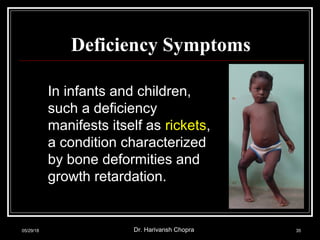 Deficiency Symptoms
In infants and children,
such a deficiency
manifests itself as rickets,
a condition characterized
by bone deformities and
growth retardation.
05/29/18 Dr. Harivansh Chopra 35
 