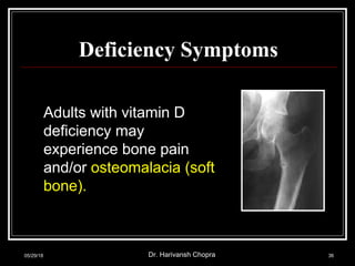 Deficiency Symptoms
Adults with vitamin D
deficiency may
experience bone pain
and/or osteomalacia (soft
bone).
05/29/18 Dr. Harivansh Chopra 36
 
