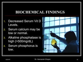 BIOCHEMICAL FINDINGS
1. Decreased Serum Vit D
Levels.
2. Serum calcium may be
low or normal.
3. Alkaline phosphatase is
high (>500mg/dL)
4. Serum phosphorus is
low.
05/29/18 Dr. Harivansh Chopra 52
 