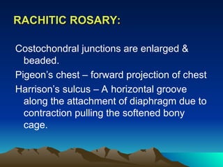 VITAMIN DEFICIENCY - PPT PRESENTATION... | PPT
