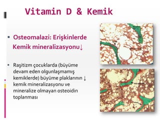Vitamin D & Kemik
 Osteomalazi: Erişkinlerde

Kemik mineralizasyonu↓
 Raşitizm çocuklarda (büyüme

devam eden olgunlaşmamış
kemiklerde) büyüme plaklarının ↓
kemik mineralizasyonu ve
mineralize olmayan osteoidin
toplanması

 