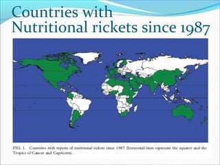 Countries with
Nutritional rickets since 1987
 