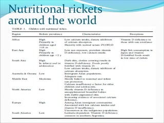 Nutritional rickets
around the world
 