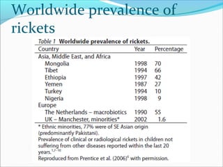 Worldwide prevalence of
rickets
 