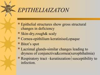 EPITHELIAIZATON
Epithelial structures show gross structural
changes in deficiency
Skin-dry,rough& scaly
Cornea-epithilium keratinised,opaque
Bitot’s spot
Lacrimal glands-similar changes leading to
dryness of conjunctiva&cornea(xerophthalmia)
Respiratory tract –keratinzation- susceptibility to
infection.
 