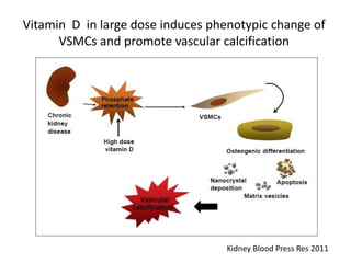 Vitamin D in large dose induces phenotypic change of
VSMCs and promote vascular calcification
Kidney Blood Press Res 2011
 