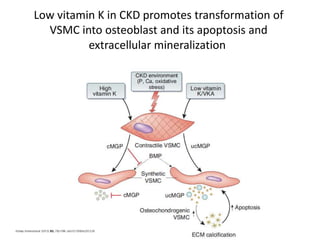 Low vitamin K in CKD promotes transformation of
VSMC into osteoblast and its apoptosis and
extracellular mineralization
 