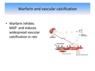 Warfarin and vascular calcification
• Warfarin inhibits
MGP and induces
widespread vascular
calcification in rats
 
