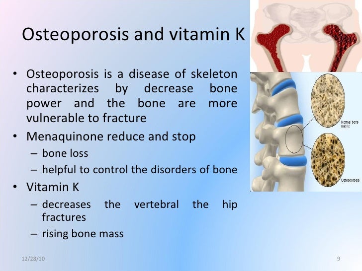 Vitamin K Tool to control the osteophrosis