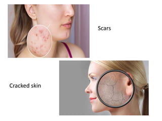 Scars
Cracked skin
 