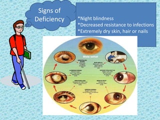 Signs of
Deficiency   *Night blindness
             *Decreased resistance to infections
             *Extremely dry skin, hair or nails
 