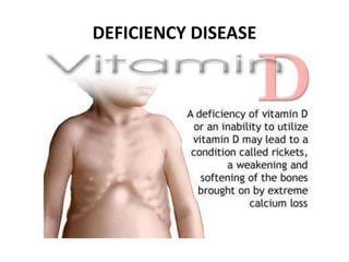 DEFICIENCY DISEASE 
 