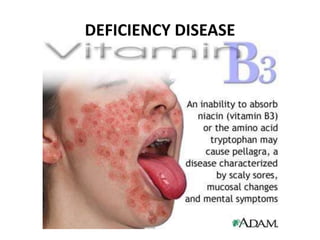 DEFICIENCY DISEASE 
 