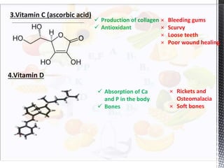 3.Vitamin C (ascorbic acid)
 Production of collagen
 Antioxidant
× Bleeding gums
× Scurvy
× Loose teeth
× Poor wound healing
4.Vitamin D
 Absorption of Ca
and P in the body
 Bones
× Rickets and
Osteomalacia
× Soft bones
 