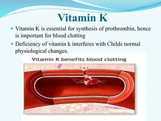 Vitamin K
 Vitamin K is essential for synthesis of prothrombin, hence
is important for blood clotting
 Deficiency of vitamin k interferes with Childs normal
physiological changes.
 