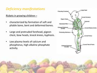 Deficiency manifestations
Rickets in growing children –
• characterized by formation of soft and
pliable bone, bent and deformed bones.
• Large and protruded forehead, pigeon
chest, bow heads, knock knees, kyphosis.
• Low plasma levels of calcium and
phosphorus, high alkaline phosphate
activity.
 