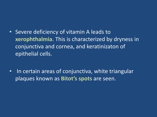 • Severe deficiency of vitamin A leads to
xerophthalmia. This is characterized by dryness in
conjunctiva and cornea, and keratinizaton of
epithelial cells.
• In certain areas of conjunctiva, white triangular
plaques known as Bitot’s spots are seen.
 