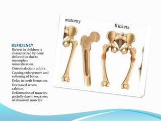 DEFICIENCY
Rickets in children is
characterized by bone
deformities due to
incomplete
mineralization.
Osteomalacia in adults.
Causing enlargement and
softening of bones.
Delay in teeth formation.
Decreased serum
calcium.
Deformation of muscles :
potbelly due to weakness
of abnomial muscles.
 