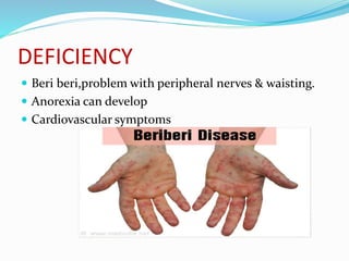 DEFICIENCY
 Beri beri,problem with peripheral nerves & waisting.
 Anorexia can develop
 Cardiovascular symptoms
 