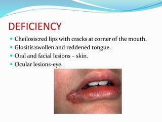 DEFICIENCY
 Cheilosis:red lips with cracks at corner of the mouth.
 Glositis:swollen and reddened tongue.
 Oral and facial lesions – skin.
 Ocular lesions-eye.
 