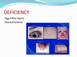 DEFICIENCY
Egg white injury
Dermal lesions
 