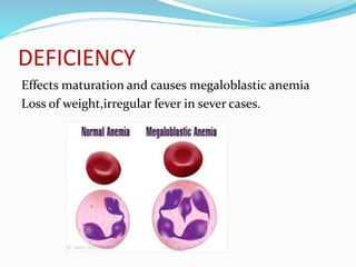 DEFICIENCY
Effects maturation and causes megaloblastic anemia
Loss of weight,irregular fever in sever cases.
 
