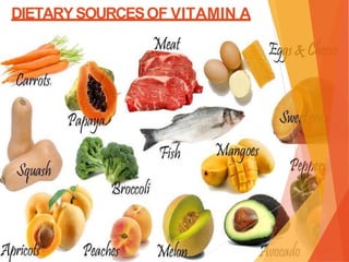 DIETARYSOURCESOF VITAMIN A
 