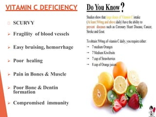 VITAMIN C DEFICIENCY
SCURVY
 Fragility of blood vessels
 Easy bruising, hemorrhage
 Poor healing
 Pain in Bones & Muscle
 Poor Bone & Dentin
formation
 Compromised immunity
 