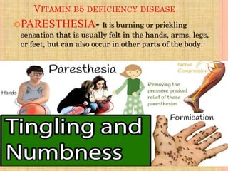 VITAMIN B5 DEFICIENCY DISEASE
PARESTHESIA- It is burning or prickling
sensation that is usually felt in the hands, arms, legs,
or feet, but can also occur in other parts of the body.
 