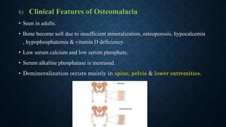 b) Clinical Features of Osteomalacia
• Seen in adults.
• Bone become soft due to insufficient mineralization, osteoporosis, hypocalcemia
, hypophosphatemia & vitamin D deficiency.
• Low serum calcium and low serum phosphate.
• Serum alkaline phosphatase is increased.
• Demineralization occurs mainly in spine, pelvis & lower extremities.
 