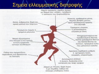 Σημεία ελλειμματικής διατροφής
 