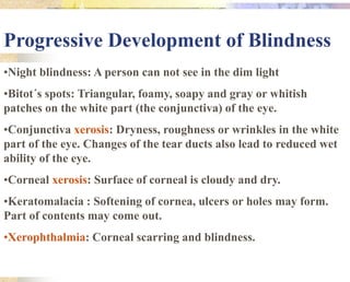•Night blindness: A person can not see in the dim light
•Bitot´s spots: Triangular, foamy, soapy and gray or whitish
patches on the white part (the conjunctiva) of the eye.
•Conjunctiva xerosis: Dryness, roughness or wrinkles in the white
part of the eye. Changes of the tear ducts also lead to reduced wet
ability of the eye.
•Corneal xerosis: Surface of corneal is cloudy and dry.
•Keratomalacia : Softening of cornea, ulcers or holes may form.
Part of contents may come out.
•Xerophthalmia: Corneal scarring and blindness.
Progressive Development of Blindness
 