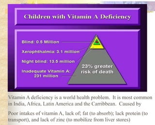 Vitamin A deficiency is a world health problem. It is most common
in India, Africa, Latin America and the Carribbean. Caused by
Poor intakes of vitamin A, lack of; fat (to absorb); lack protein (to
transport), and lack of zinc (to mobilize from liver stores)
 
