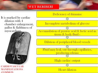 It is marked by cardiac
dilation with 4
chamber enlargement,
pallor & flabbiness of
myocardium.
CARDIOVASCULAR
MANIFESTATIONS
-COMMON
 
