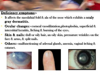 Deficiency symptomsDeficiency symptoms :-:-
• It affects the nasolabial fold & ala of the nose which exhibits aIt affects the nasolabial fold & ala of the nose which exhibits a scalyscaly
gray dermatitis.gray dermatitis.
• Ocular changesOcular changes:-:- corneal vasodilatation,photophobia, superficial &corneal vasodilatation,photophobia, superficial &
interstitial keratitis, Itching & burning of the eyes.interstitial keratitis, Itching & burning of the eyes.
• Skin & nailsSkin & nails:: dull or oily hairdull or oily hair,, an oily skin, premature wrinkles on thean oily skin, premature wrinkles on the
face & arms, & split nails.face & arms, & split nails.
• Others:Others:-- malfunctioning of adrenal glands, anemia, vaginal itching &malfunctioning of adrenal glands, anemia, vaginal itching &
cataract.cataract.
 